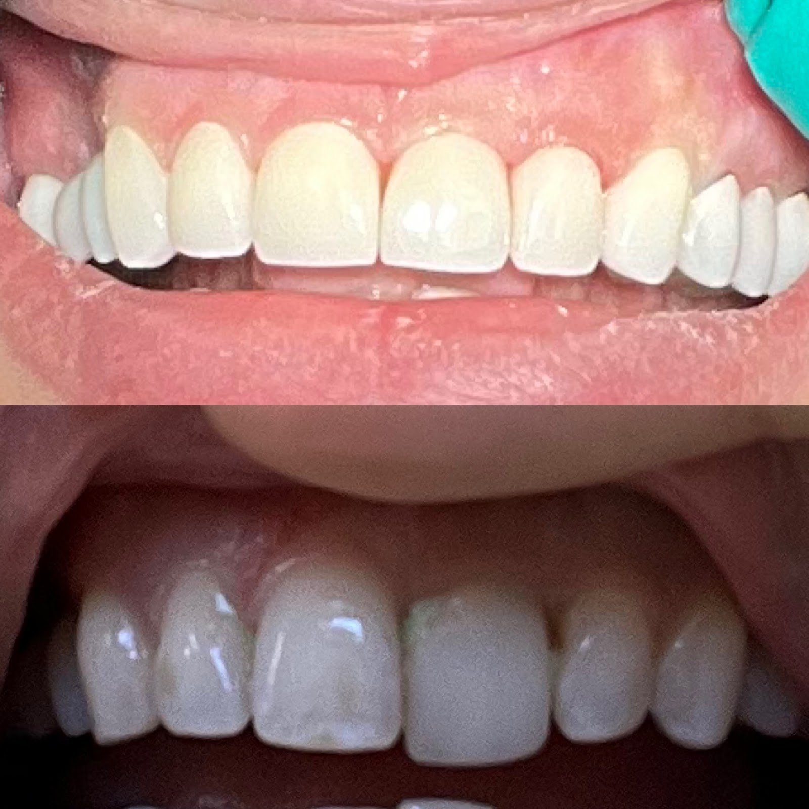 Livonia cosmetic, Implant and sedation center in Livonia